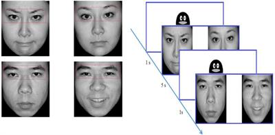 Repetitive transcranial magnetic stimulation can improve the fixation of eyes rather than the fixation preference in children with autism spectrum disorder